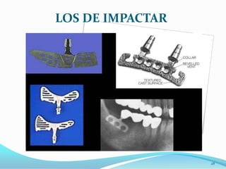 LOS DE IMPACTAR




                  28
 