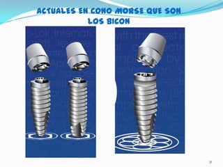 ACTUALES EN CONO MORSE QUE SON
           LOS BICON




                                 31
 