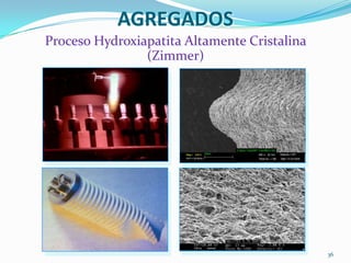 AGREGADOS
Proceso Hydroxiapatita Altamente Cristalina
                (Zimmer)




                                              36
 
