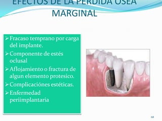 EFECTOS DE LA PERDIDA OSEA
          MARGINAL

 Fracaso temprano por carga
  del implante.
 Componente de estés
  oclusal
 Aflojamiento o fractura de
  algun elemento protesico.
 Complicaciónes estéticas.
 Enfermedad
  periimplantaria

                               68
 