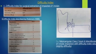 Difficulty Index
 A. Difficulty index for surgical extraction of impacted 3rd molar:
B.Difficulty index described by Pederson (1988):
Fig: Mesioangular Class 2 level A Mandibular
3rd molar impaction with difficulty index value
(slightly difficulty)
 