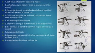  A. soft tissue reflection by a standard incision
 B. vertical stop cut is made by chisel at anterior end of the
wound
 C. horizontal stop cut is made backwards from a point just
above the lower end of vertical cut.
 D.Excision of triangular piece of bone bounded ant. By the
lower end of stop cut.
 c. the distolingual bone fracture.
 d. Separation of lingual plate from rest of the alveolar bone.
 E.The peninsula of bone,between thwe lingual & buccal cut is
excised.
 F.displacement of tooth
 G.lingual plates are grasped in the fine haemostat & soft tissues
are freed from it.
 H. smoothening of the bone by bone file
 