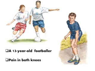A 13-year-old footballer
Pain in both knees
 