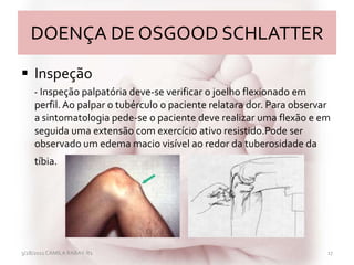 DOENÇA DE OSGOOD SCHLATTER
 Inspeção
- Inspeção palpatória deve-se verificar o joelho flexionado em
perfil. Ao palpar o tubérculo o paciente relatara dor. Para observar
a sintomatologia pede-se o paciente deve realizar uma flexão e em
seguida uma extensão com exercício ativo resistido.Pode ser
observado um edema macio visível ao redor da tuberosidade da
tíbia.
3/28/2011 CAMILA RABAY-R1 17
 