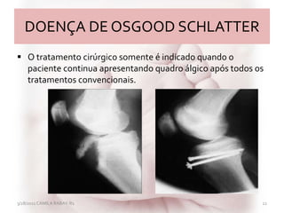 DOENÇA DE OSGOOD SCHLATTER
 O tratamento cirúrgico somente é indicado quando o
paciente continua apresentando quadro álgico após todos os
tratamentos convencionais.
3/28/2011 CAMILA RABAY-R1 22
 