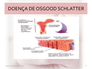 DOENÇA DE OSGOOD SCHLATTER
3/28/2011 CAMILA RABAY-R1 8
 