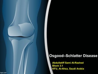 Osgood–Schlatter Disease 
Abdullatiff Sami Al-Rashed 
Block 3.1 
KFU, Al-Ahsa, Saudi Arabia 
 