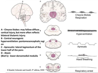 A - Cheyne-Stokes: may follow diffuse
cortical injury, but more often reflects
bilateral thalamic injury.
B - Central neurogenic
hyperventilation: pontomesencephalic regi
on
C - Apneustic: lateral tegmentum of the
lower half of the pons
D - Ataxic
(Biot’s): lower dorsomedial medulla
www.dnbpediatrics.com
 