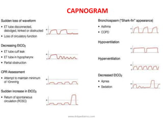 CAPNOGRAM
www.dnbpediatrics.com
 