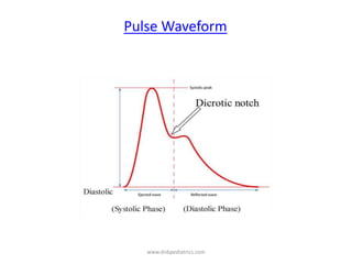 Pulse Waveform
www.dnbpediatrics.com
 
