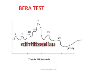 BERA TEST
www.dnbpediatrics.com
 