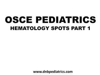 OSCE PEDIATRICS
HEMATOLOGY SPOTS PART 1
www.dnbpediatrics.com
 