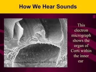 How We Hear Sounds
This
electron
micrograph
shows the
organ of
Corti within
the inner
ear
 