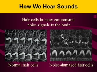 How We Hear Sounds
Normal hair cells Noise-damaged hair cells
Hair cells in inner ear transmit
noise signals to the brain
 