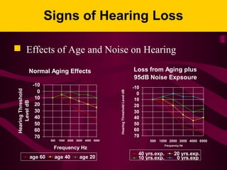 Signs of Hearing Loss
 Effects of Age and Noise on Hearing
Normal Aging Effects
-10
0
10
20
30
40
50
60
70
500 1000 2000 3000 4000 6000
Frequency Hz
HearingThreshold
LeveldB
age 60 age 40 age 20
Loss from Aging plus
95dB Noise Expsoure
-10
0
10
20
30
40
50
60
70
500 1000 2000 3000 4000 6000
Frequency Hz
HearingThresholdLeveldB
40 yrs.exp. 20 yrs.exp.
10 yrs.exp. 0 yrs.exp
 