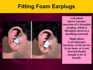 Fitting Foam Earplugs
Left photo
shows a proper
insertion of a formable
earplug, which is
fibreglass down in a
sheathing material.
Right photo
is an improper
insertion, as the device
is too loose, or is not
inserted deeply
enough to be of
benefit.
 