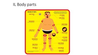 IL Body parts
 