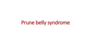 Prune belly syndrome
 