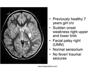 • Previously healthy 7
years girl c/o
• Sudden onset
weakness right upper
and lower limb
• Facial palsy right
(UMN)
• Normal sensorium
• No fever/ trauma/
seizures
L
c
t
www.dnbpediatrics.com
 