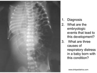 1. Diagnosis
2. What are the
embryologic
events that lead to
this development?
3. What are three
causes of
respiratory distress
in a baby born with
this condition?
www.dnbpediatrics.com
 
