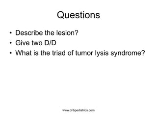 Questions
• Describe the lesion?
• Give two D/D
• What is the triad of tumor lysis syndrome?
www.dnbpediatrics.com
 