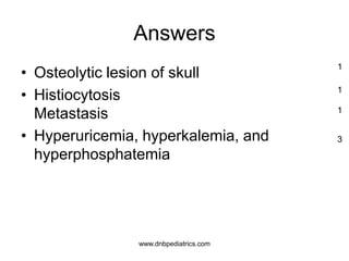 Answers
• Osteolytic lesion of skull
• Histiocytosis
Metastasis
• Hyperuricemia, hyperkalemia, and
hyperphosphatemia
1
1
1
3
www.dnbpediatrics.com
 