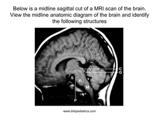 Below is a midline sagittal cut of a MRI scan of the brain.
View the midline anatomic diagram of the brain and identify
the following structures
www.dnbpediatrics.com
 
