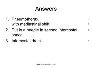 Answers
1. Pneumothorax,
with mediastinal shift
2. Put in a needle in second intercostal
space
3. Intercostal drain
1
1
1
1
www.dnbpediatrics.com
 
