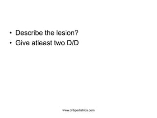• Describe the lesion?
• Give atleast two D/D
www.dnbpediatrics.com
 