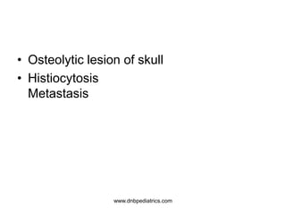 • Osteolytic lesion of skull
• Histiocytosis
Metastasis
www.dnbpediatrics.com
 