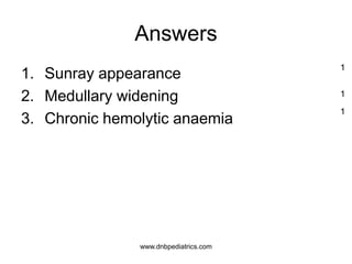 Answers
1. Sunray appearance
2. Medullary widening
3. Chronic hemolytic anaemia
1
1
1
www.dnbpediatrics.com
 