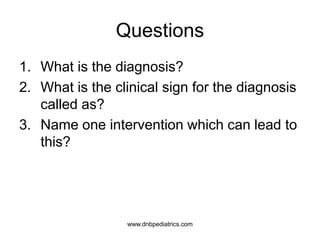 Questions
1. What is the diagnosis?
2. What is the clinical sign for the diagnosis
called as?
3. Name one intervention which can lead to
this?
www.dnbpediatrics.com
 