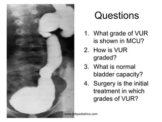 Questions
1. What grade of VUR
is shown in MCU?
2. How is VUR
graded?
3. What is normal
bladder capacity?
4. Surgery is the initial
treatment in which
grades of VUR?
www.dnbpediatrics.com
 