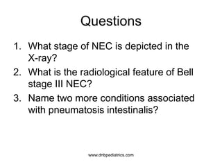 Questions
1. What stage of NEC is depicted in the
X-ray?
2. What is the radiological feature of Bell
stage III NEC?
3. Name two more conditions associated
with pneumatosis intestinalis?
www.dnbpediatrics.com
 