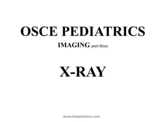 OSCE PEDIATRICS
IMAGING part three
X-RAY
www.dnbpediatrics.com
 