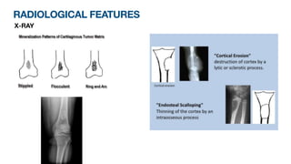 RADIOLOGICAL FEATURES
X-RAY
 