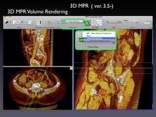 Mpr Volume Rendering OsiriX_new_guide_202204.pdf