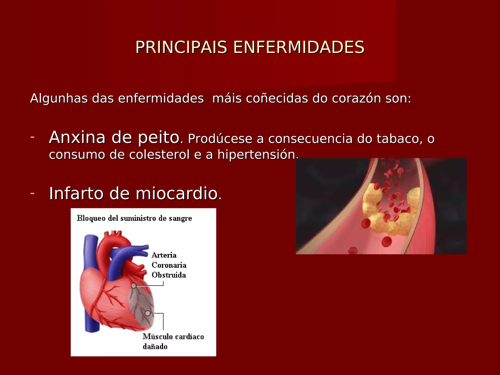 PRINCIPAIS ENFERMIDADESPRINCIPAIS ENFERMIDADES
Algunhas das enfermidades máis coñecidas do corazón son:Algunhas das enfermidades máis coñecidas do corazón son:
- Anxina de peitoAnxina de peito. Prodúcese a consecuencia do tabaco, o. Prodúcese a consecuencia do tabaco, o
consumo de colesterol e a hipertensión.consumo de colesterol e a hipertensión.
- Infarto de miocardioInfarto de miocardio..
 