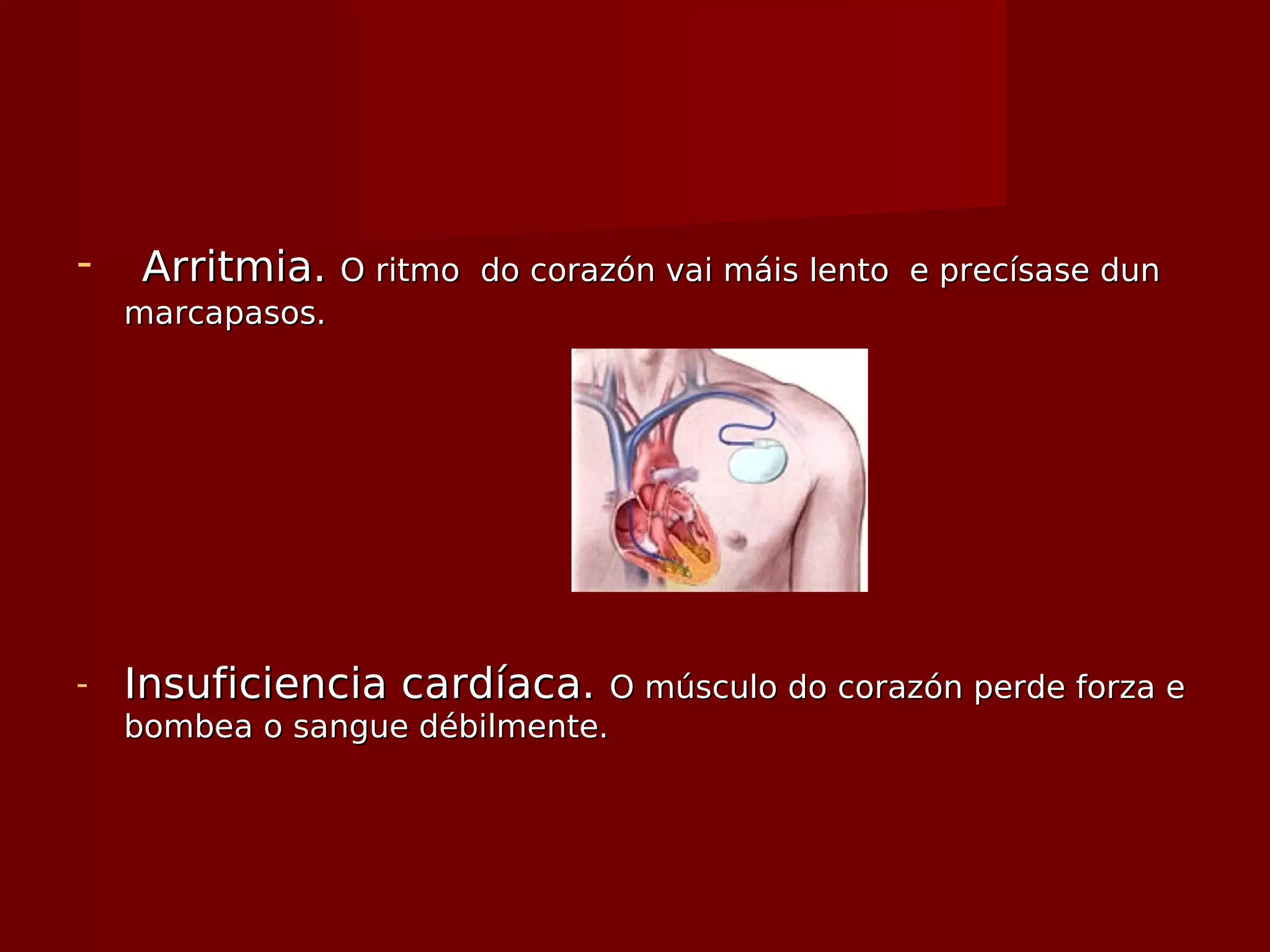 - Arritmia.Arritmia. O ritmo do corazón vai máis lento e precísase dunO ritmo do corazón vai máis lento e precísase dun
marcapasos.marcapasos.
- Insuficiencia cardíaca.Insuficiencia cardíaca. O músculo do corazón perde forza eO músculo do corazón perde forza e
bombea o sangue débilmente.bombea o sangue débilmente.
 