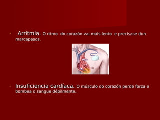 - Arritmia.Arritmia. O ritmo do corazón vai máis lento e precísase dunO ritmo do corazón vai máis lento e precísase dun
marcapasos.marcapasos.
- Insuficiencia cardíaca.Insuficiencia cardíaca. O músculo do corazón perde forza eO músculo do corazón perde forza e
bombea o sangue débilmente.bombea o sangue débilmente.
 