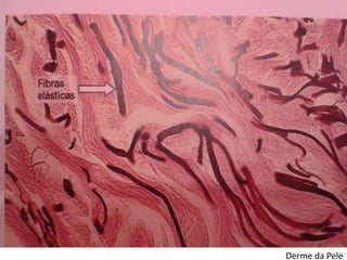 Derme da Pele 
• 5.25 
 