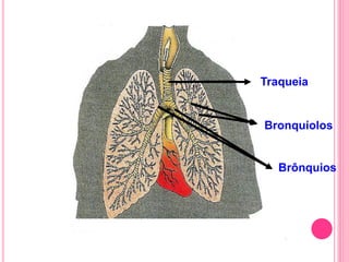 Brônquios
Bronquíolos
Traqueia
 