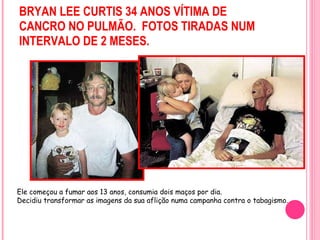 BRYAN LEE CURTIS 34 ANOS VÍTIMA DE CANCRO NO PULMÃO. FOTOS TIRADAS NUM INTERVALO DE 2 MESES. Ele começou a fumar aos 13 anos, consumia dois maços por dia.  Decidiu transformar as imagens da sua aflição numa campanha contra o tabagismo.  