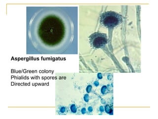 Aspergillus fumigatus
Blue/Green colony
Phialids with spores are
Directed upward
 