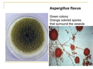 Aspergillus flavus
Green colony
Orange colored spores
that surround the vesecle
 