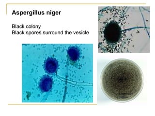 Aspergillus niger
Black colony
Black spores surround the vesicle
 