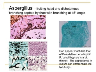 Aspergillus – fruiting head and dichotomous
branching septate hyphae with branching at 45* angle
Can appear much like that
of Pseudallescheria boydii!
P. boydii hyphae is a bit
thinner. The appearance in
culture can differentiate the
two fungi.
 