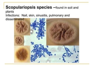 Scopulariopsis species –found in soil and
plants
Infections: Nail, skin, sinusitis, pulmonary and
disseminated
 