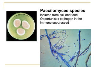 Paecilomyces species
Isolated from soil and food
Opportunistic pathogen in the
immune suppressed
 