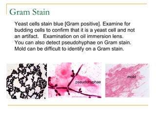 Yeast cells stain blue [Gram positive]. Examine for
budding cells to confirm that it is a yeast cell and not
an artifact. Examination on oil immersion lens.
You can also detect pseudohyphae on Gram stain.
Mold can be difficult to identify on a Gram stain.
pseudohyphae
mold
pseudohyphae
Gram Stain
 